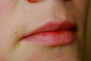 Hur man tar bort en mustasch från en tjej: professionella och folkliga metoder Hur man tar bort en kvinnlig mustasch