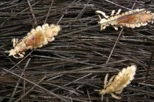 Can lice appear due to nervousness and stress?