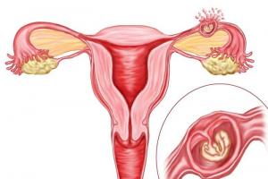 Varför gör äggstockarna ont under graviditeten Under graviditeten är äggstocken stor