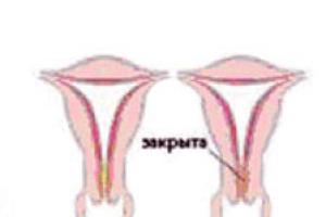 What should the cervix be like before menstruation?